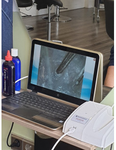 diagnostinė kamera plaukams... 2