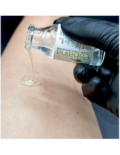 losjonas po depiliacijos... 2